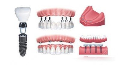 郑州华西口腔门诊部怎么样?专家医生|项目收费标准