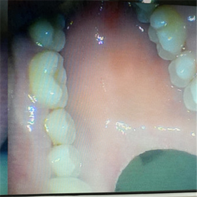 更新过的郑州牙科医院前十位都有谁?看哪家种植牙价格低
