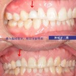 郑州种植牙医生高功杰