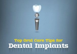 郑州种植牙牙博仕口腔好不好