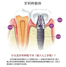 郑州种植牙如何选择靠谱牙科？全面解析医院选择要点
