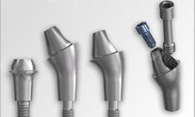 郑州种植牙费用详解 从三千起步，品牌与型号对价格影响显著，建议到院咨询