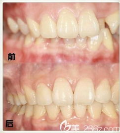 徐菲 郑州华领美佳网种植牙专家的专业之旅